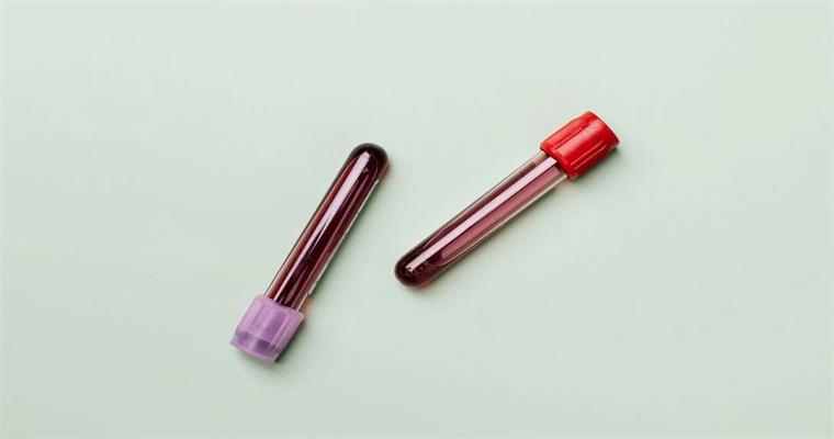 医疗器械领域：电火花机是实现微型精密部件加工的核心设备